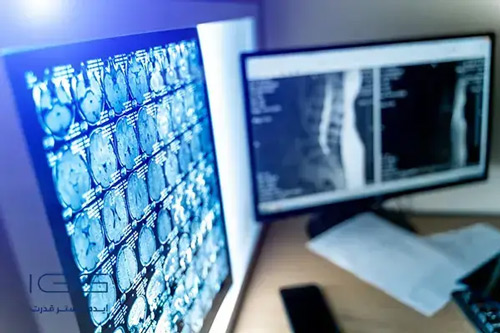 آموزشی تصویربرداری مغز